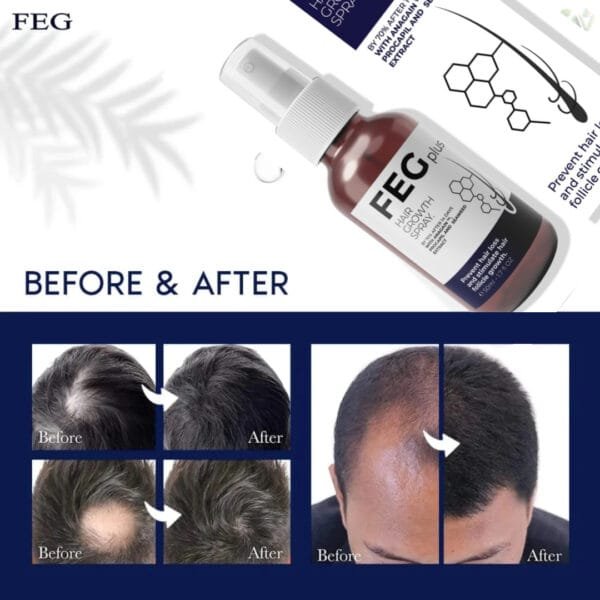 FEGPLUS Hair And Beard Growth Serum The Revolutionary Formula for Hair Regrowth - Image 2